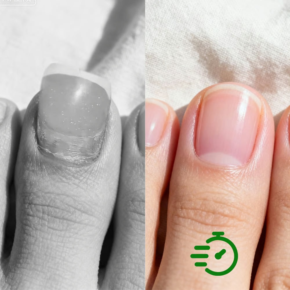 Antifungal Nail Repair Solution-👩‍⚕️Permanent with no side effects