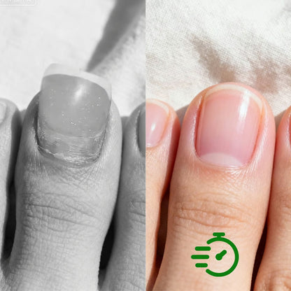Antifungal Nail Repair Solution-👩‍⚕️Permanent with no side effects